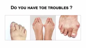 1 Pair Blue Soft Silicone Gel Toe Separator Hallux Valgus Bunion Spacers Thumb Corrector Foot Care Tool